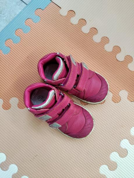 Protetika prechodné dievčenské tenisky, protetika,21