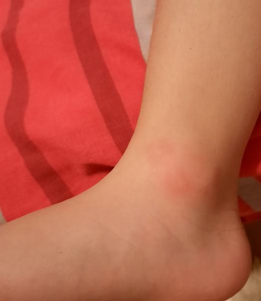 Je pôvod titulku štípanca dôvodom na obavy?