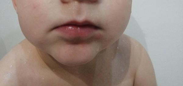 Vždy keď príde zo škôlky, má pod ústmai červené fľaky.