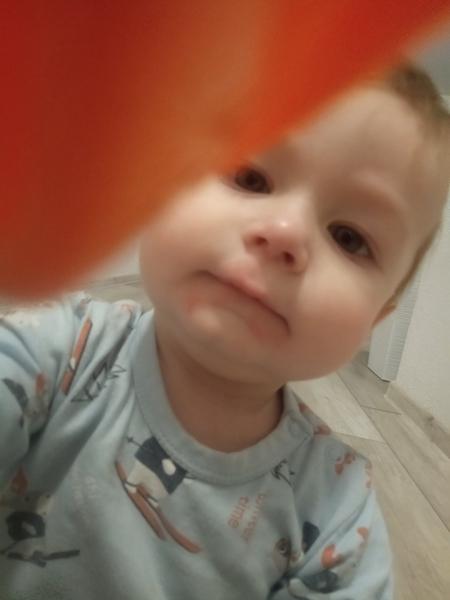 Prečo sa 10-mesačnému synovi tvoria červené fľaky okolo úst?