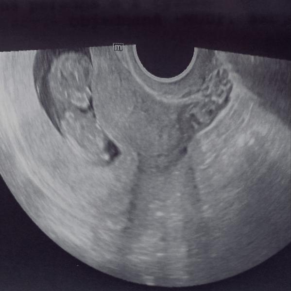 Je podľa vás bábätko v poriadku?