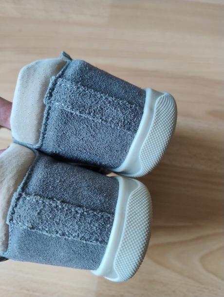 Ortopedické sandálky protetika, protetika,25