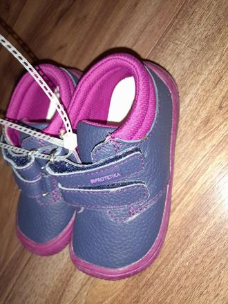 Nové protetika topánky, protetika,22