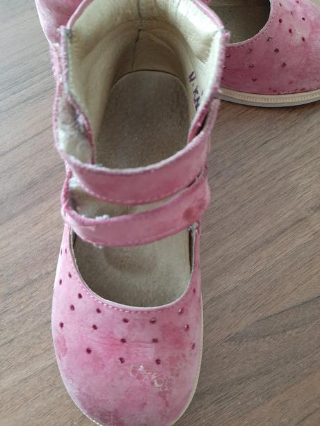 Sandalky ortopedicke, protetika,26