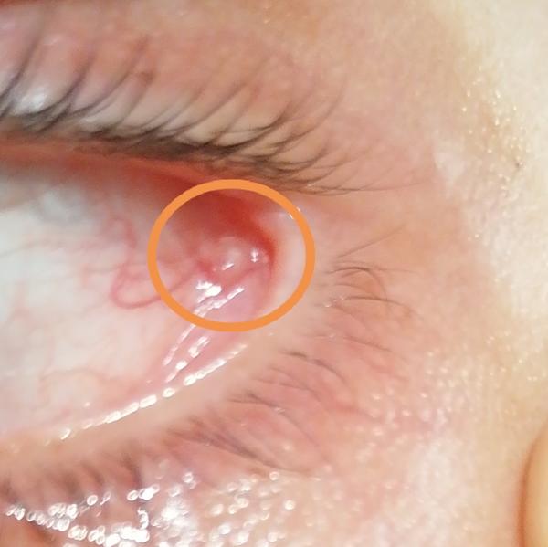 Niečo sa mi urobilo v oku