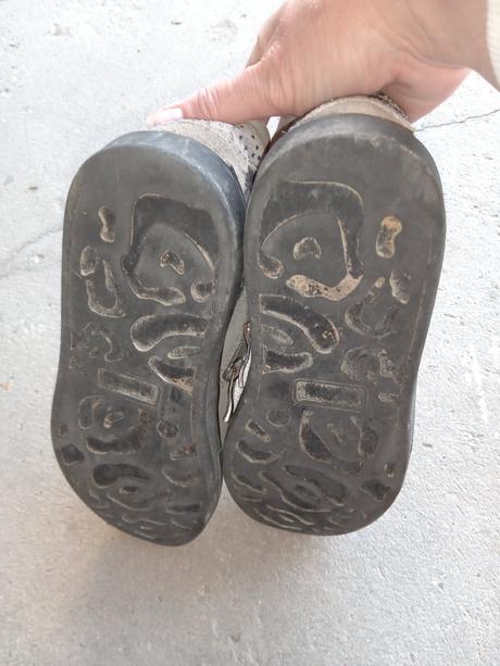 Topanky, protetika,34