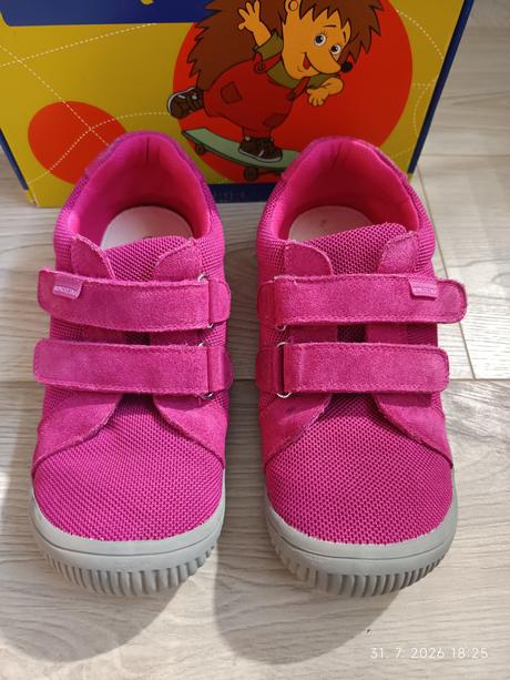 Protetika dony fuxia, protetika,35