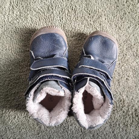 Prechodne topanky protetika 26, protetika,26