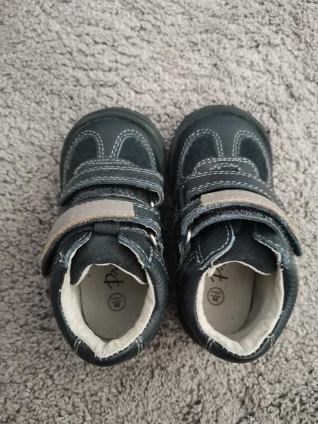 Topánočky protetika, protetika,20