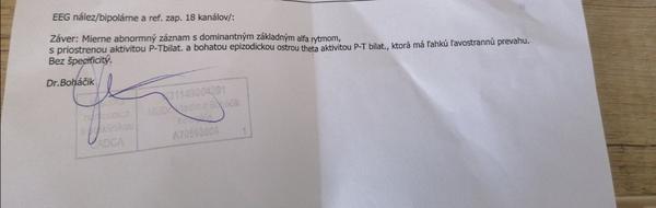 Čo nie je v poriadku na mojich EEG výsledkoch?