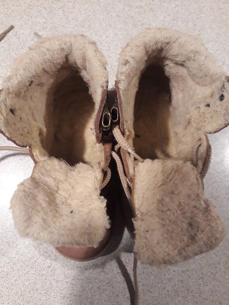 Zimne ortopedicke topanočky, protetika,24