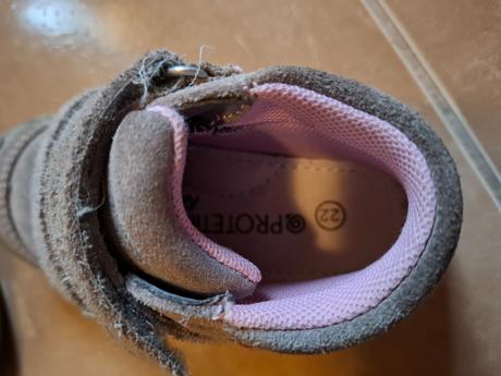 Prechodné topánočky protetika, protetika,22