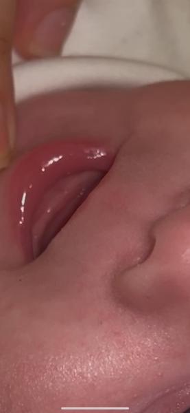 Vyzerá to na zúbky?