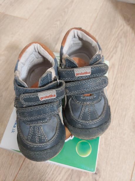 Celorocne protetika niko, protetika,21