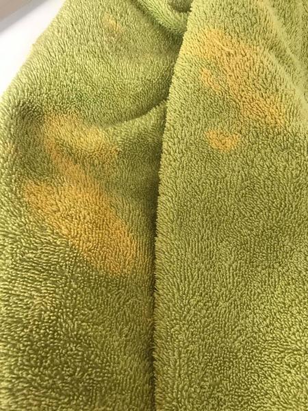 Z čoho mi vznikajú škvrny na obliečkach a uterákoch?