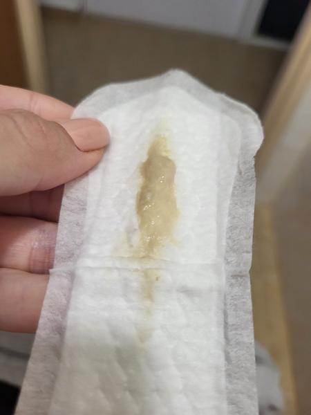 Je čudný výtok v tehotenstve normálny?