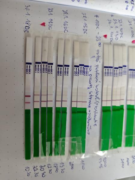 Ovulačný test pri PCOS - skúsenosti s liečbou Clostilbegytom