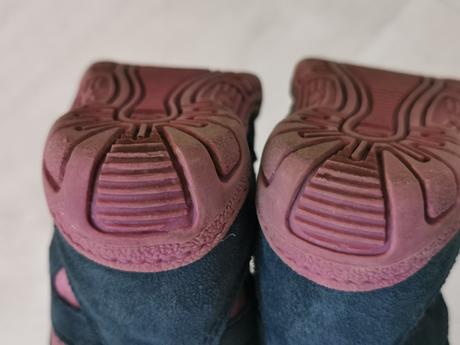 Zimné topánky protetika mira, protetika,21