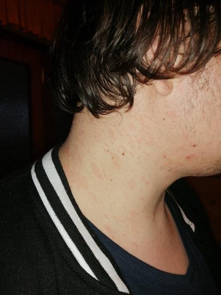 Čo sú tieto červené fľaky?