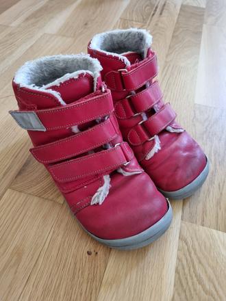 Beda zimne topanky, beda,33