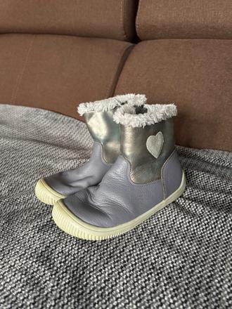 Protetika topanky, protetika,31