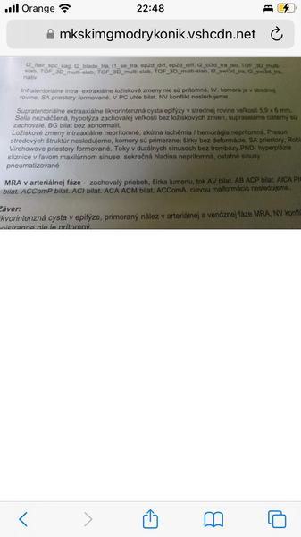 MRI hlavy - výsledky