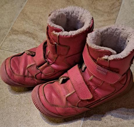 Čižmy protetika, protetika,30