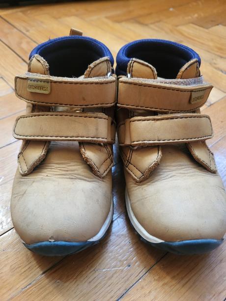 Prechodné topanky protetika, protetika,25