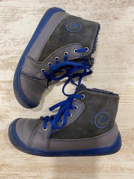 Protetika amis, protetika,30