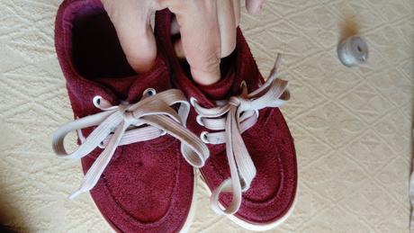 Platenky, protetika,26