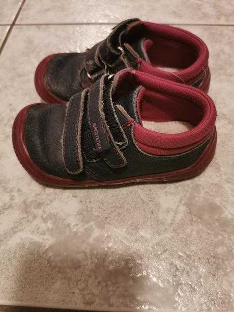 Protetika bf topanocky, protetika,22