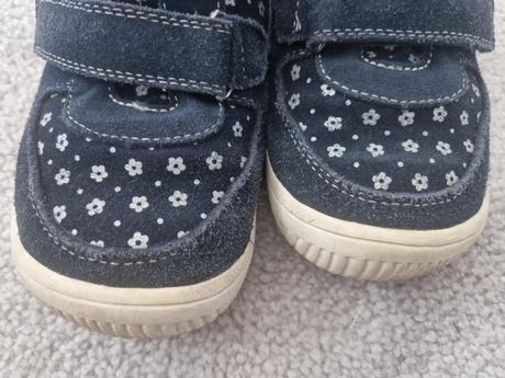 Topanky, protetika,32