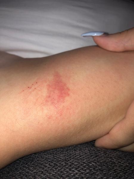 Čo znamená tento červený fľak?