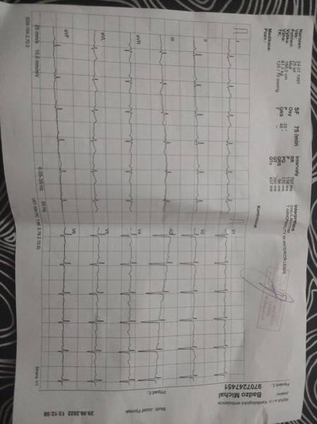 Sú moje výsledky v poriadku?