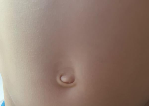 Je to pruh alebo niečo iné?