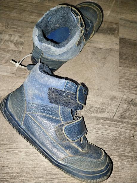 Topanky protetika, protetika,28