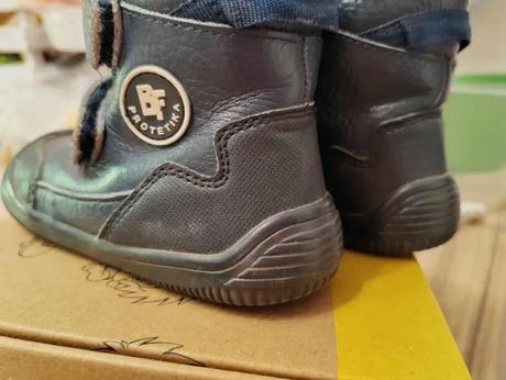 Barefoot protetika, protetika,22