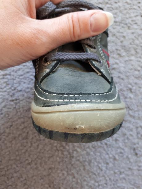 Topánky protetika, veľ. 21, protetika,21