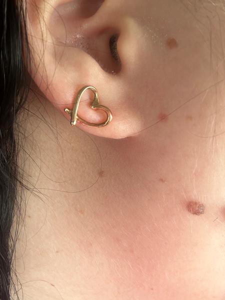 Môže mať znamienko dve farby?