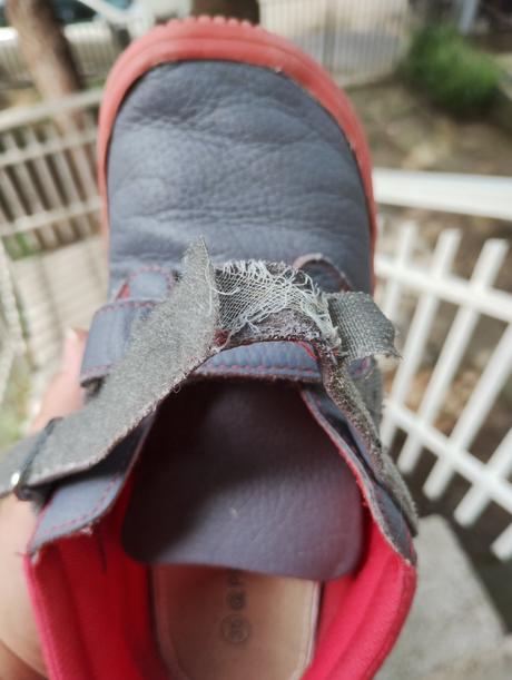 Barefoot tenisky, protetika,35