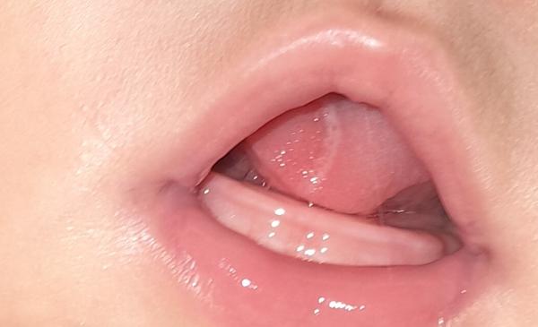 Čo to má moje 6-mesačné bábätko na jazyku?