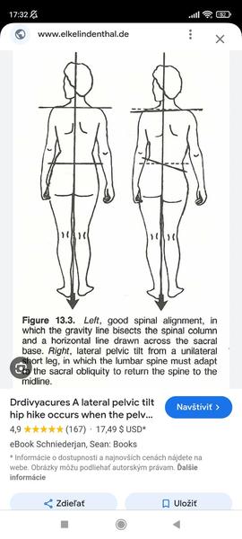 Kde nájsť kvalitnú fyzioterapiu v Bratislave?