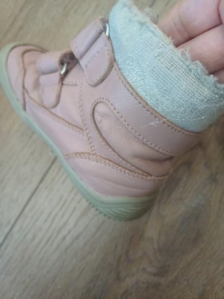 Topanky, protetika,24