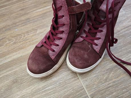 Prechodné topánky č.33, protetika,33