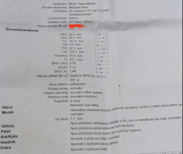 Určenie termínu pôrodu