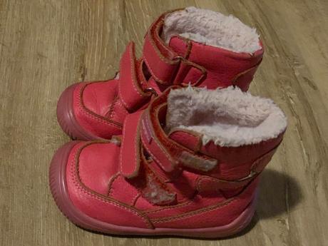 Zimne cizmicky protetika, protetika,21