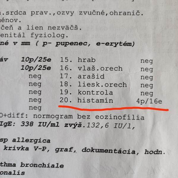 Čo znamená tento údaj z alergológie?