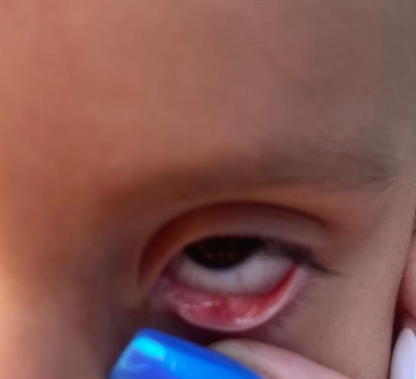 Čo robiť, keď očná ignoruje problém?