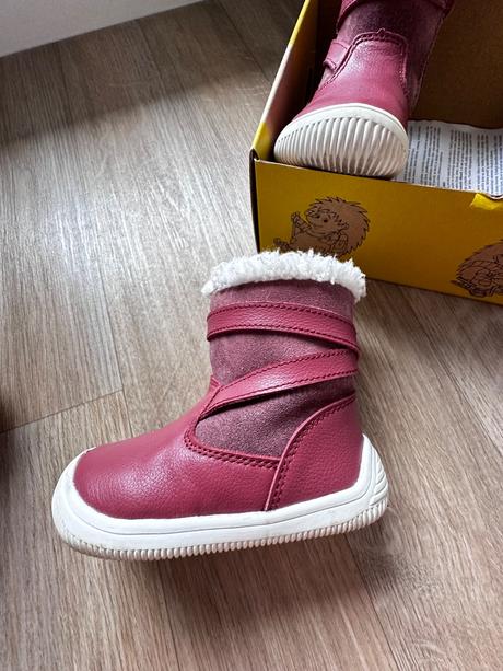 Čižmy protetika, protetika,21