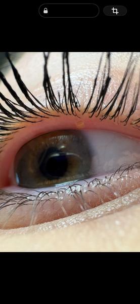 Nečakaná zmena na oku'